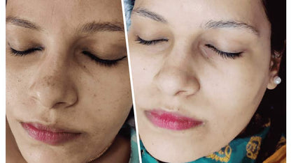 Glow & Clean Urgent Whitening Facial