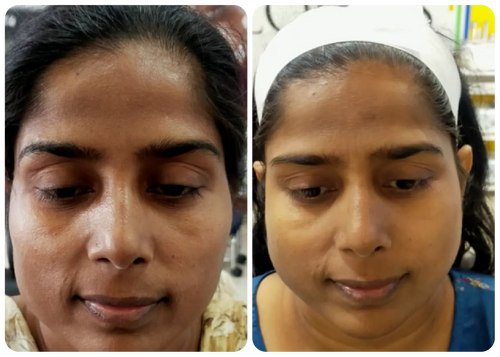 DERMA ONE GOLD SKIN POLISH
